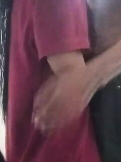 Amputee